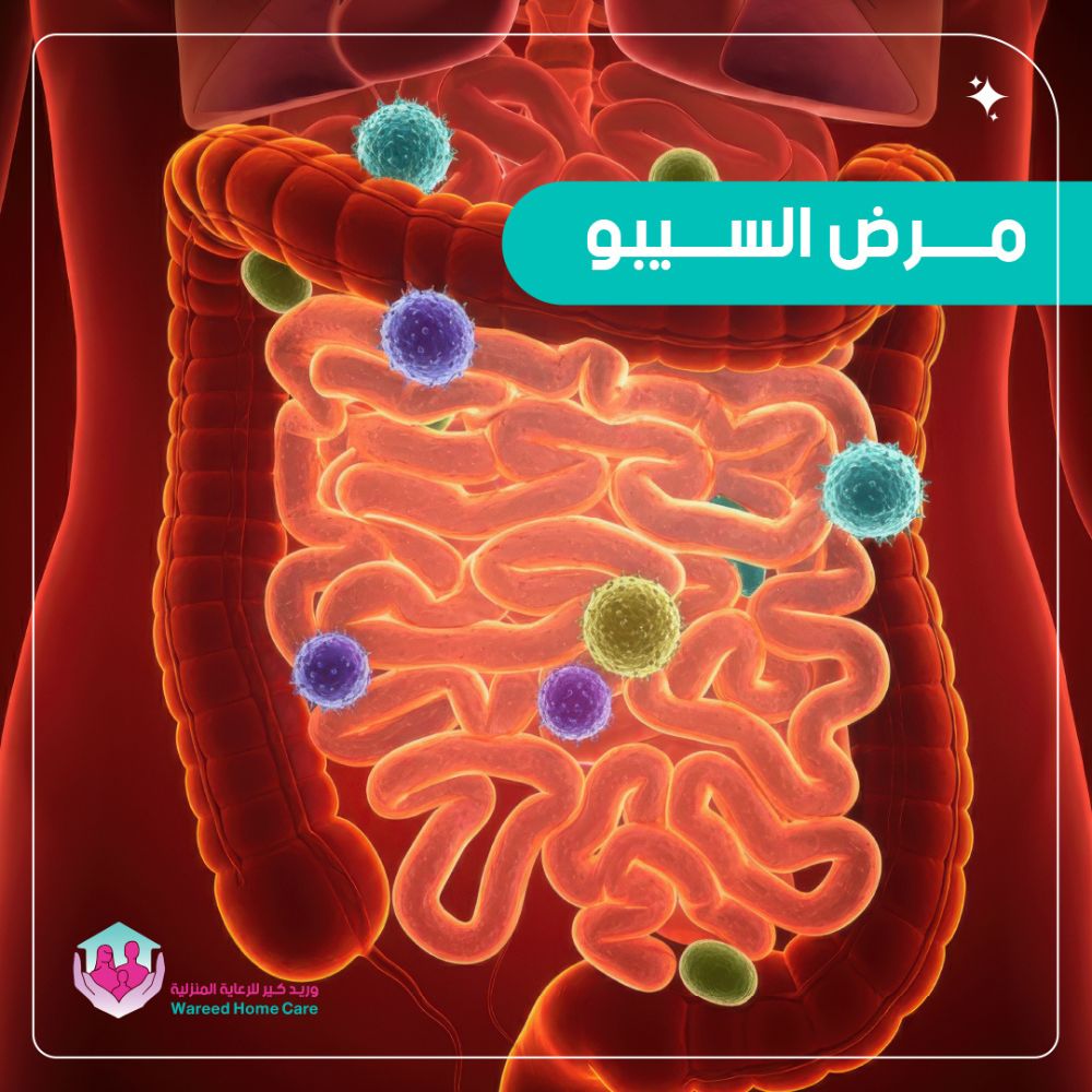 مرض السيبو