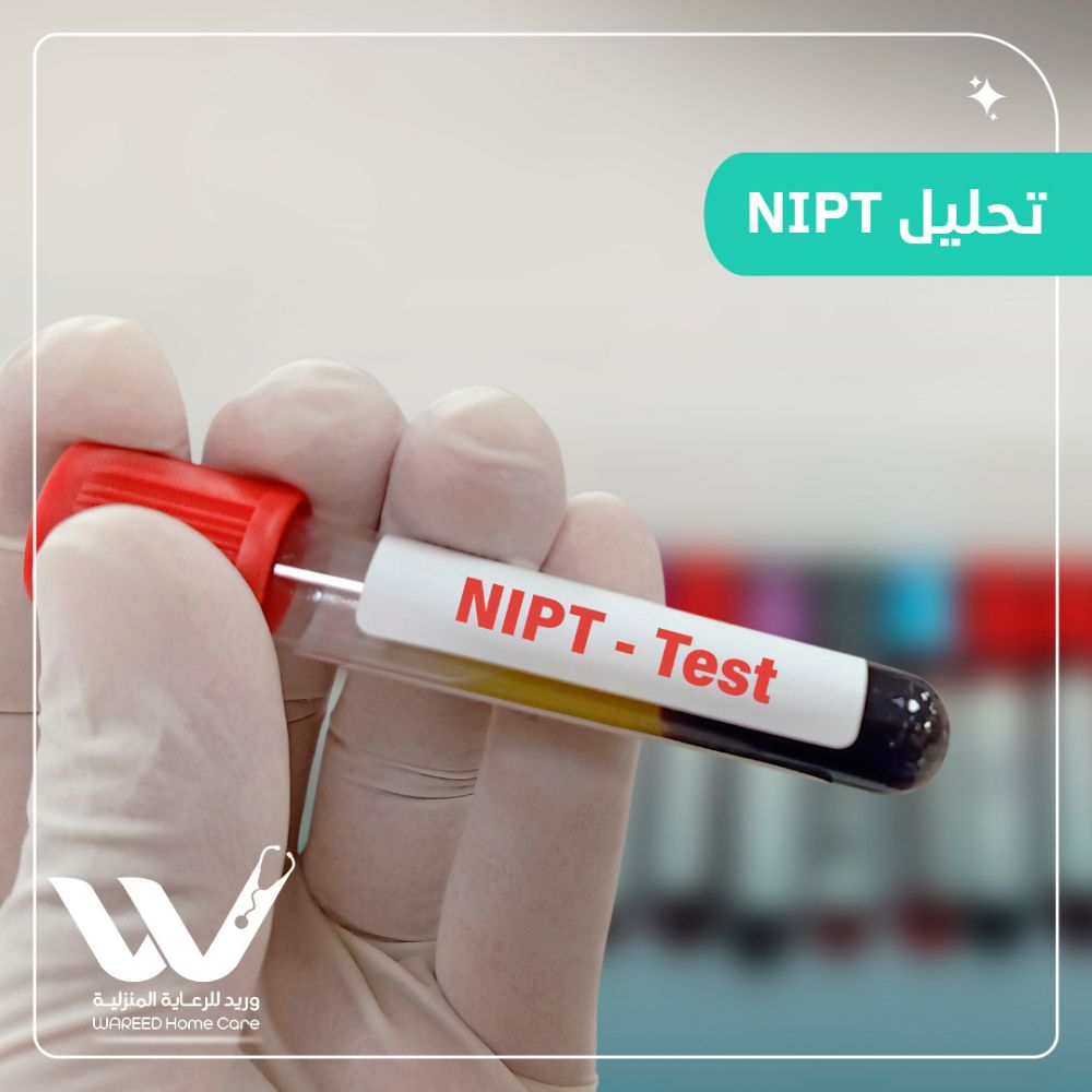 فهم تحليل NIPT: كل ما تحتاج معرفته