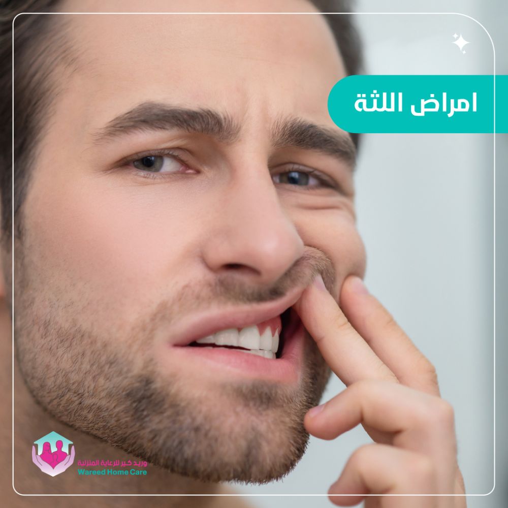 أسباب وأعراض أمراض اللثة الشائعة