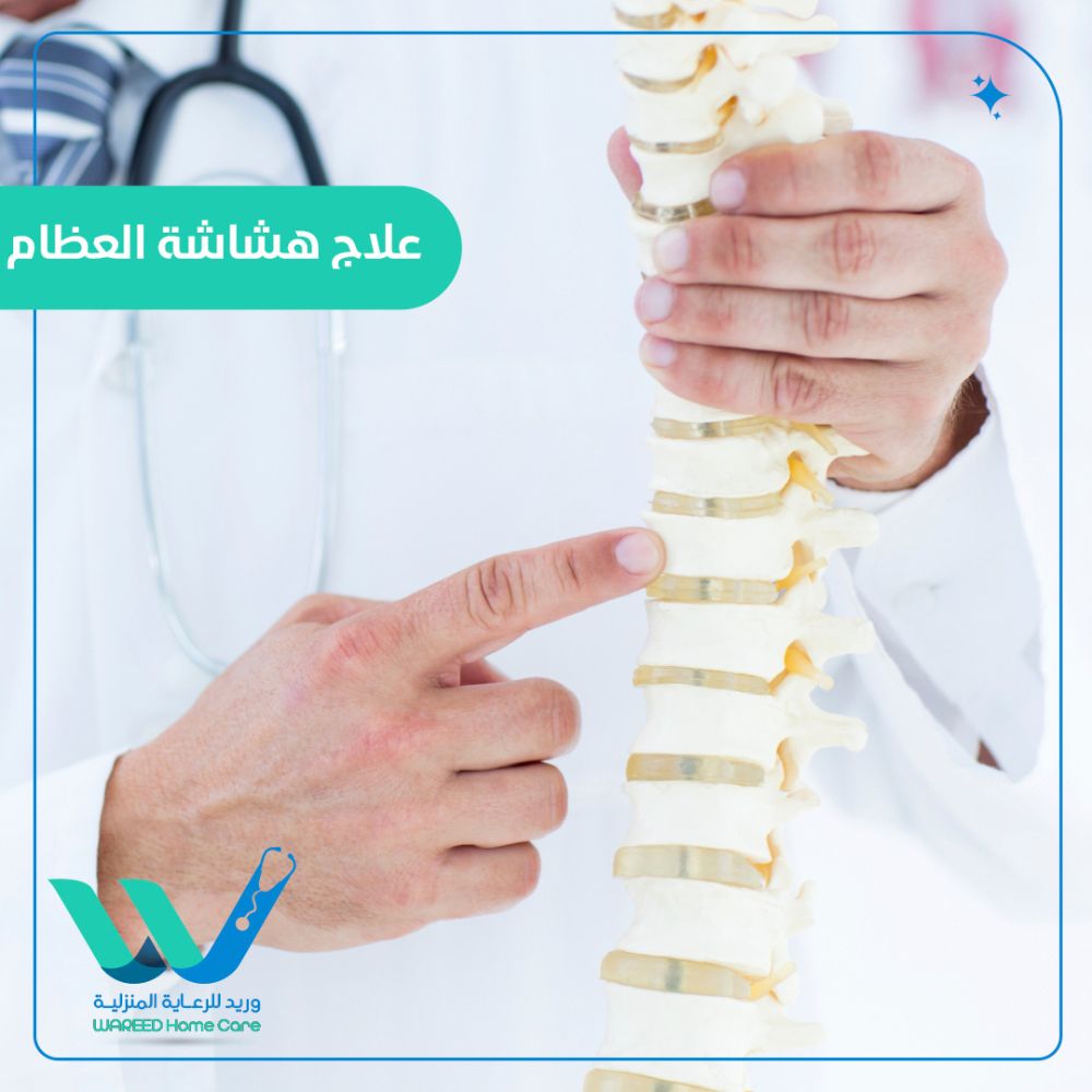 طرق فعالة لعلاج هشاشة العظام