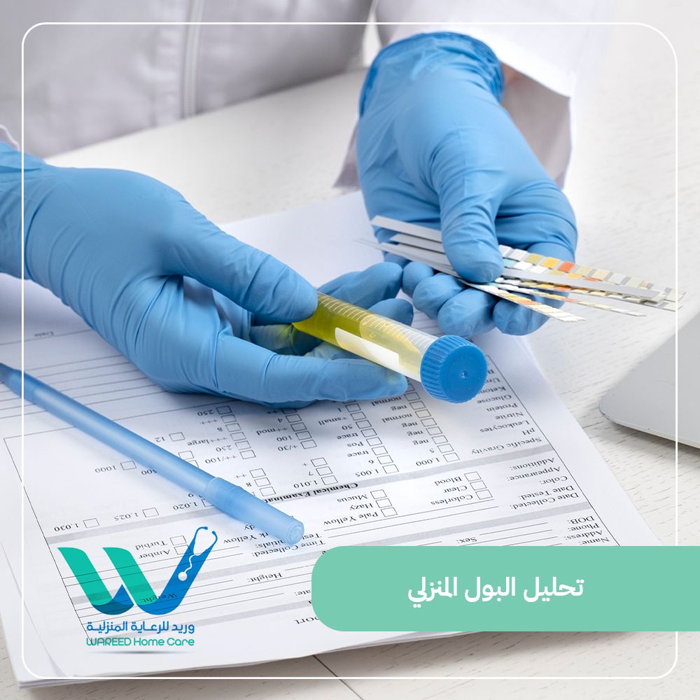 فوائد تحليل البول المنزلي ودقته