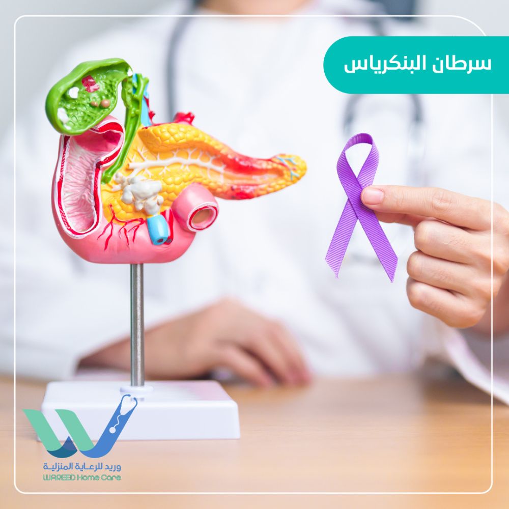 سرطان البنكرياس