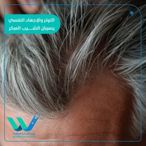 التوتر والإجهاد النفسي يسبب الشيب